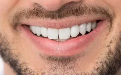 Soins dentaires au Luxembourg : comment passer d’une dentition abîmée à un sourire sain