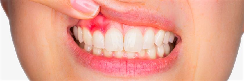 PORODONTOLOGIE Parodontie