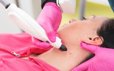 Plexr au Luxembourg : une alternative efficace à la chirurgie